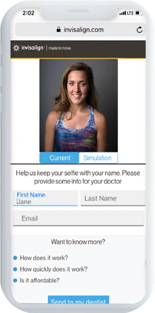 Quick facts about Invisalign treatment