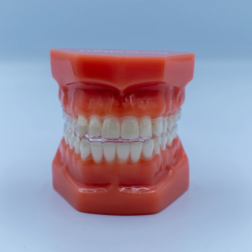 Dental model demonstrating Invisalign clear aligner treatment